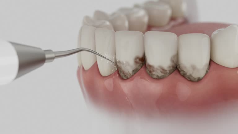 Trusted Wisdom Tooth Removal service in North Enid, OK - Dentist Open Now